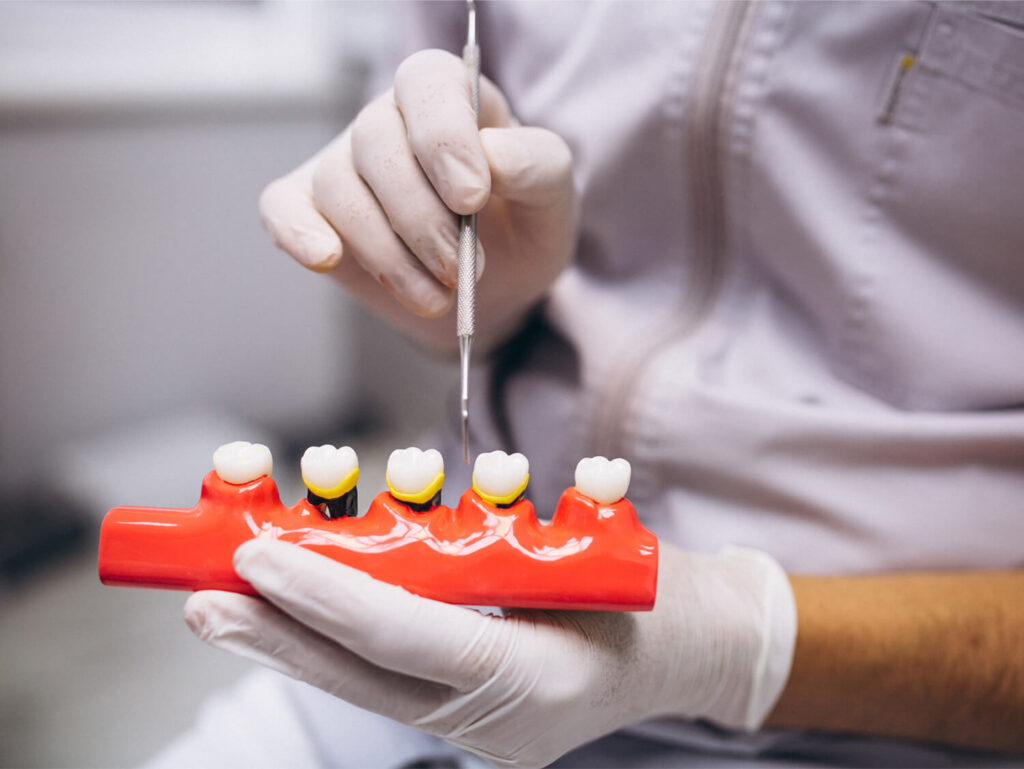 Dental Time Dentista Cesano Maderno Brianza Prevenzione Corone Ponti Dentali