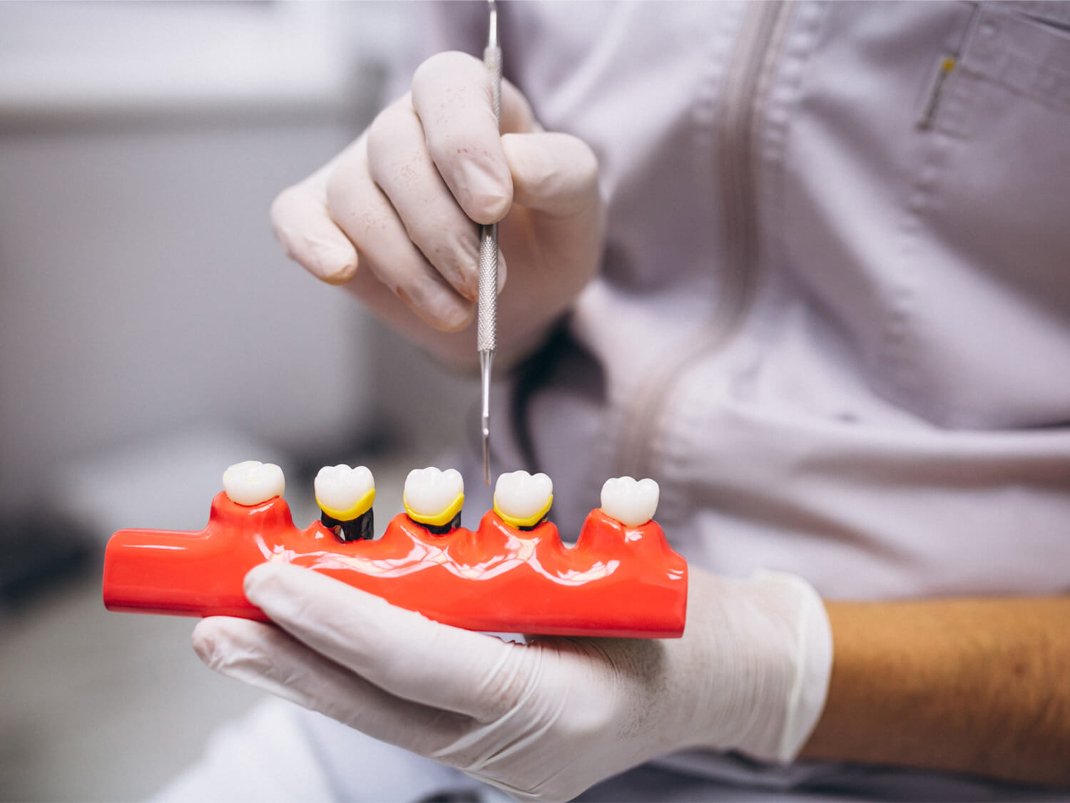 Dental Time Dentista Cesano Maderno Brianza Prevenzione Corone Ponti Dentali