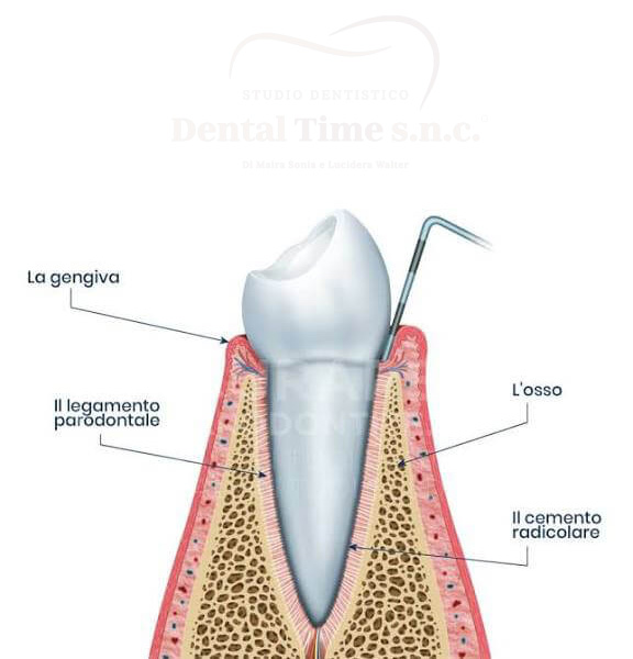 Dental Time Guida Piorrea Paradontite cure rimedi